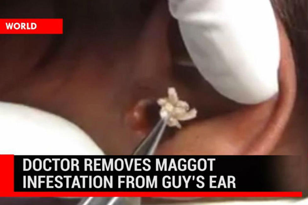 A Man’s Complaint Of Buzzing Sound Leads to Maggot Infestation in His Ear
