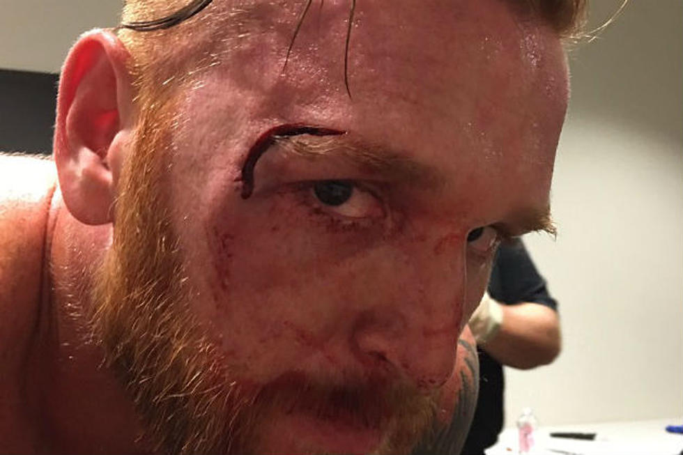 PHOTOS: WWE Star Suffers Vicious Injury At Live Event In Bangor