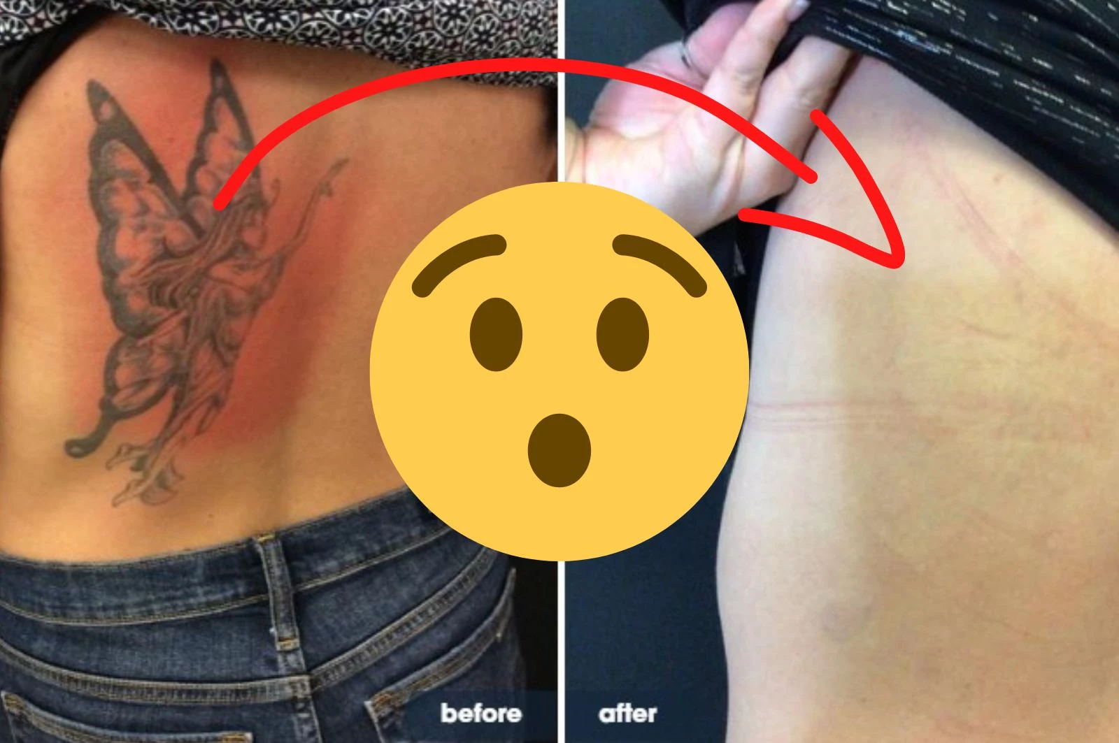 THE BEST 10 Tattoo Removal in New York NY  Last Updated August 2023  Yelp