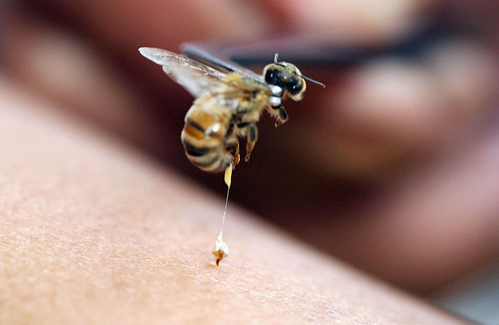 6 Things You’ll Need Next Time You Get Stung By a Bee
