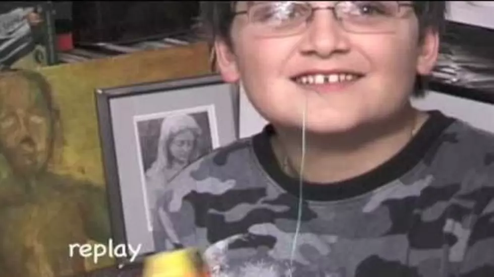 Attention Kids- Loose Tooth? Use A Nerf Gun [Video]