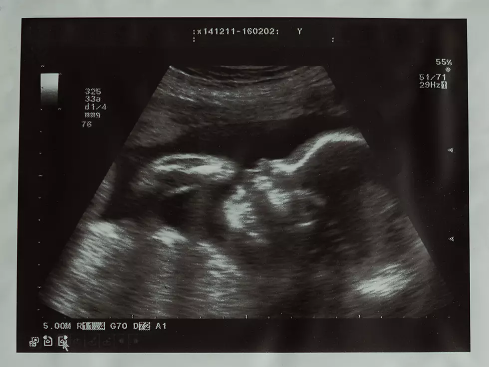Expecting? Free Pregnancy Ultrasounds This Fall, Here’s How to Sign Up!