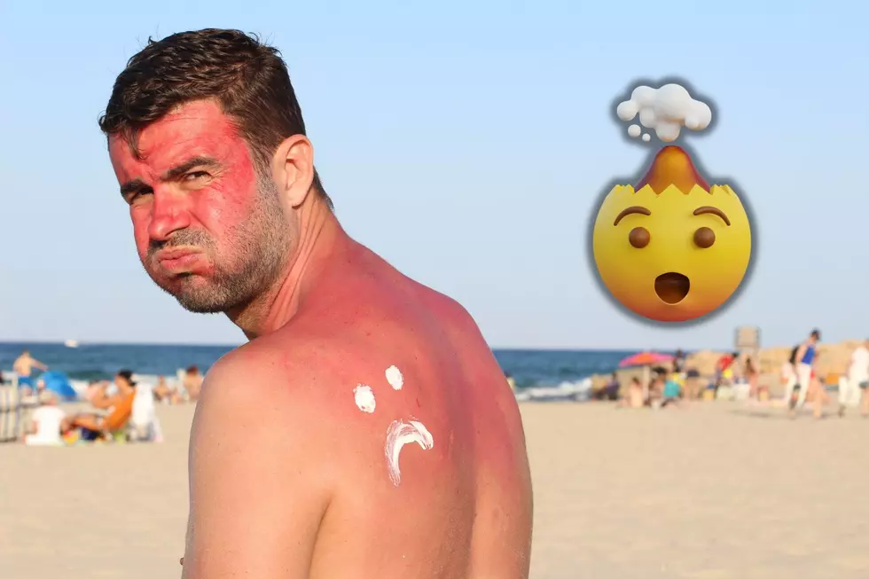 Did You Know About These Weird Little-Known Sunburn Relief Remedies?