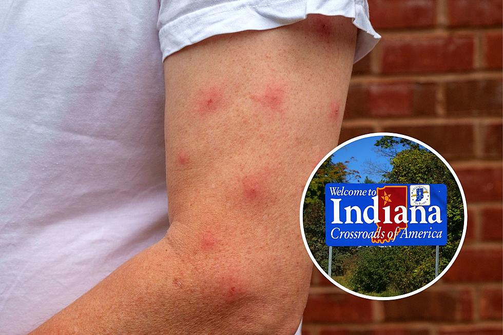 Amazing Bug Bite Healing Hack Found in Your Indiana Yard