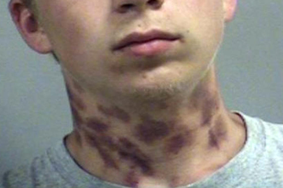 Kentucky “Hickey King” Arrested For Trespassing