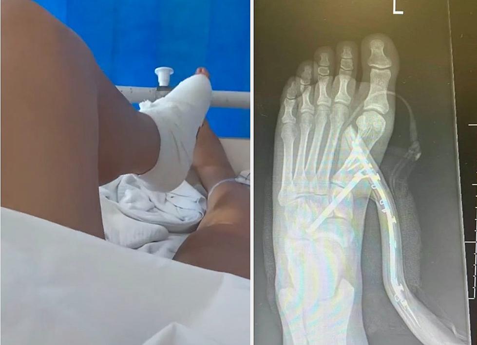 Woman’s High Heel Goes Through Her Foot While Trying To Escape A Spider