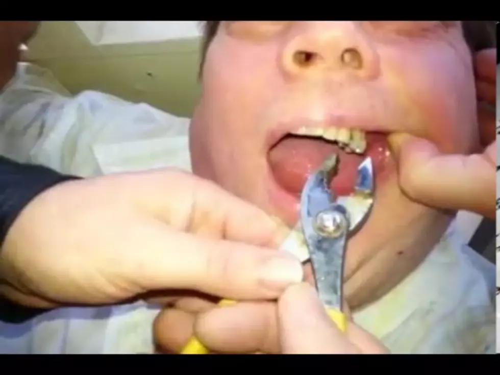 OUCH: Watch Backyard Dental Work in Action