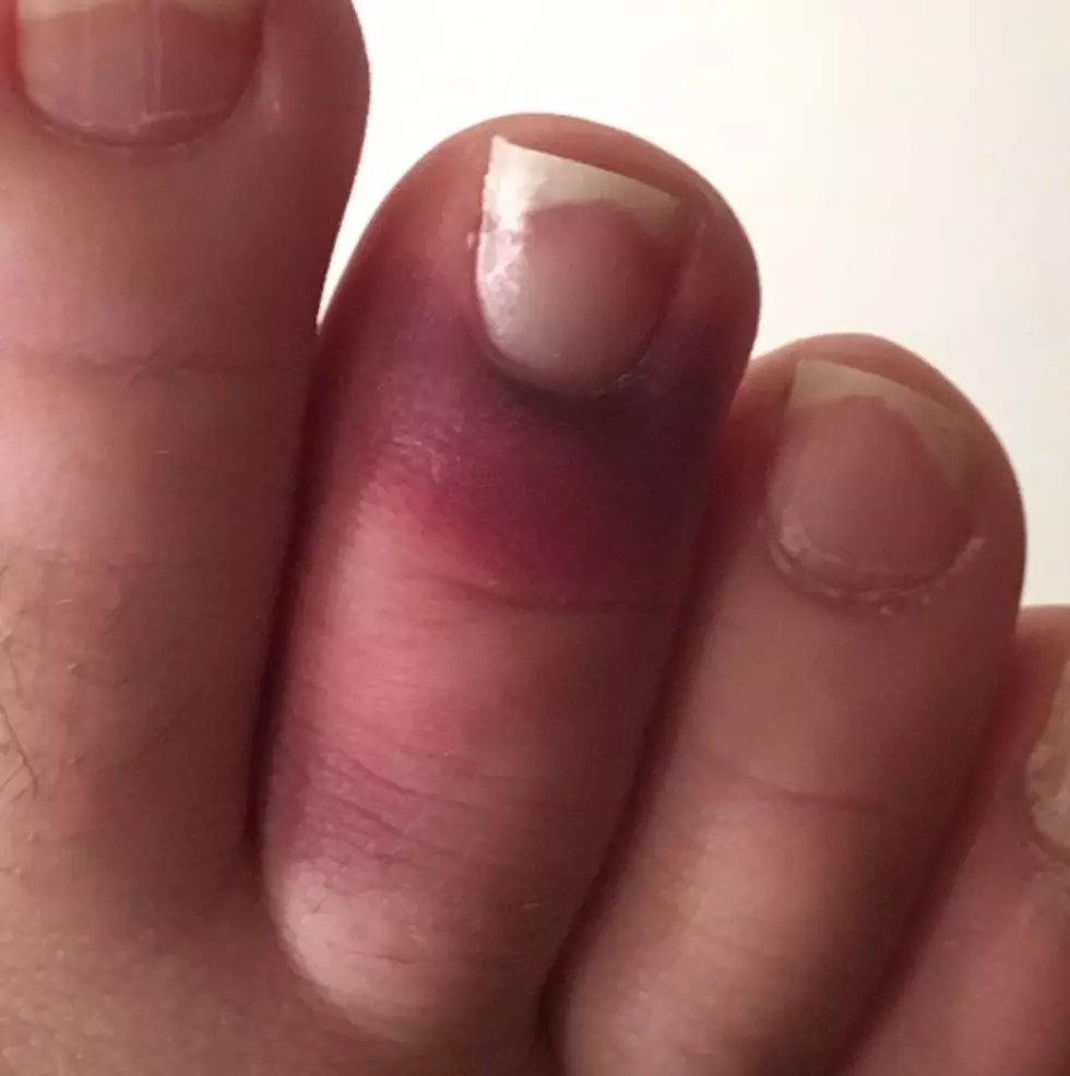 How Did Val Do This To Her Toe? – [WATCH]