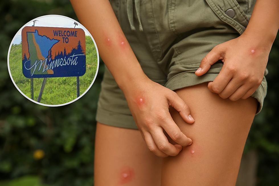 Amazing Bug Bite Hack is Right in Your Backyard in Minnesota