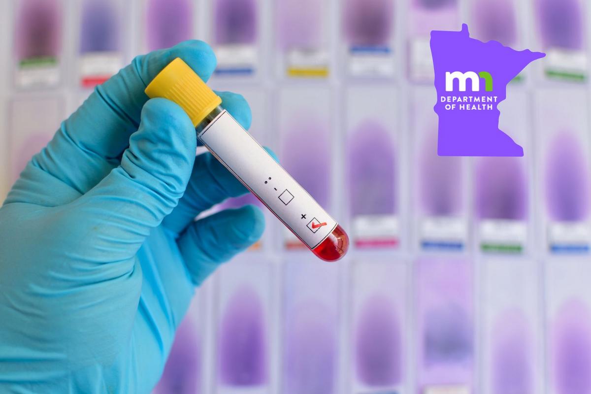 Rare Virus Has Now Killed Two People in Minnesota