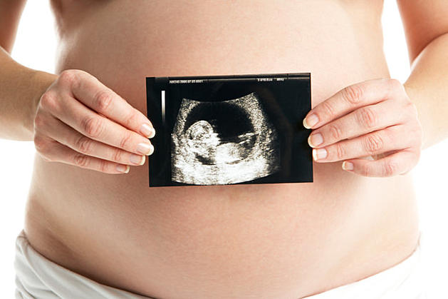 Expecting?  Here&#8217;s How to Get a Free Pregnancy Ultrasound at USI