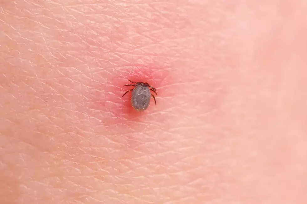 The tick bites the person
