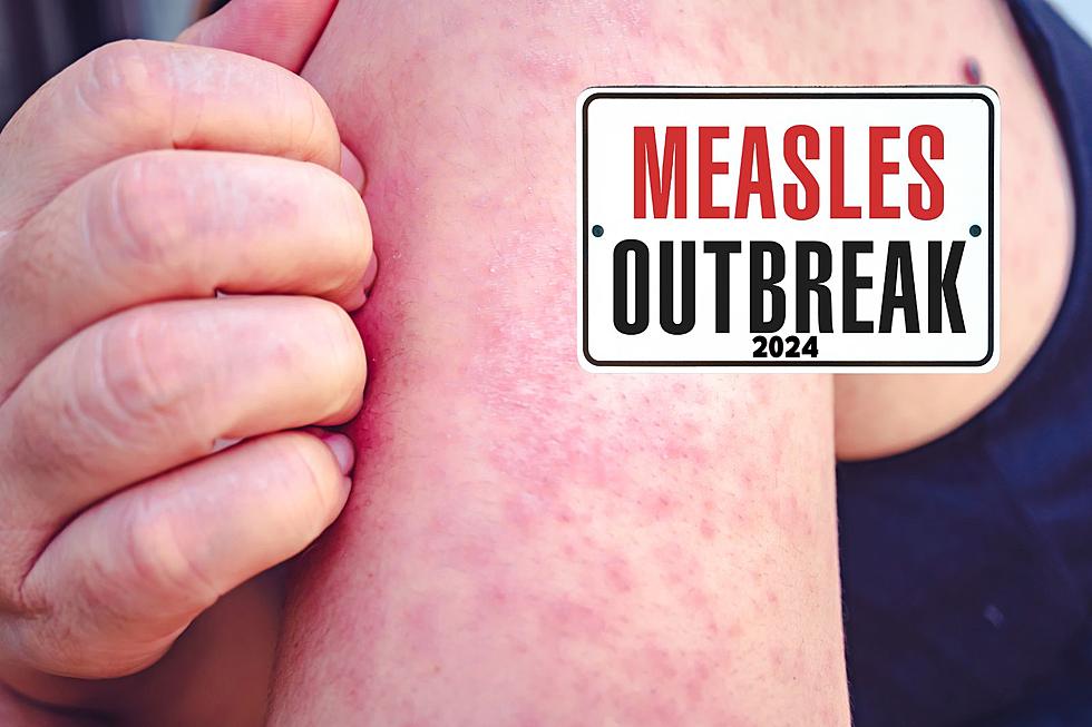 Measles Outbreak Across 15 States Including Indiana: Everything You Need to Know