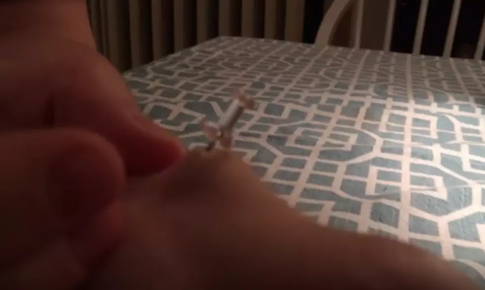 There’s A Video Of A Guy Popping A Cyst With A Thumbtack