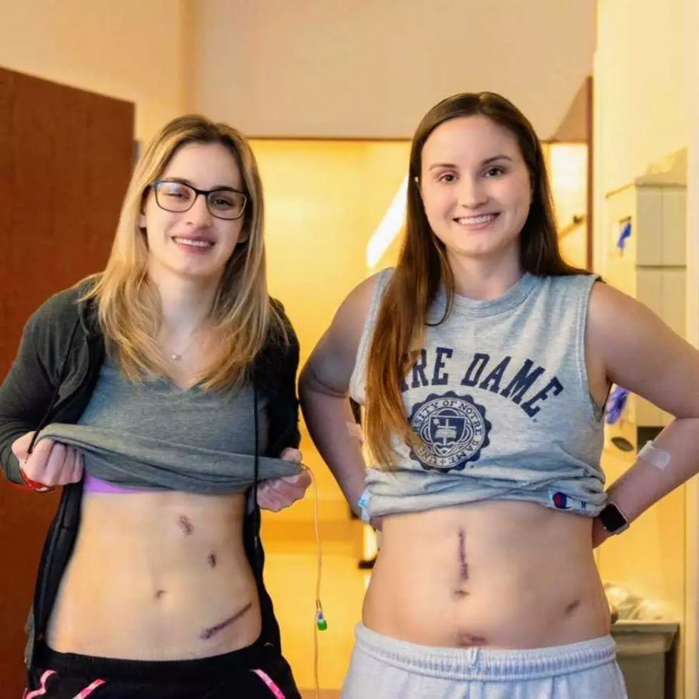 Two Chicago Sisters Donated Their Kidneys In Honor Of Late Father
