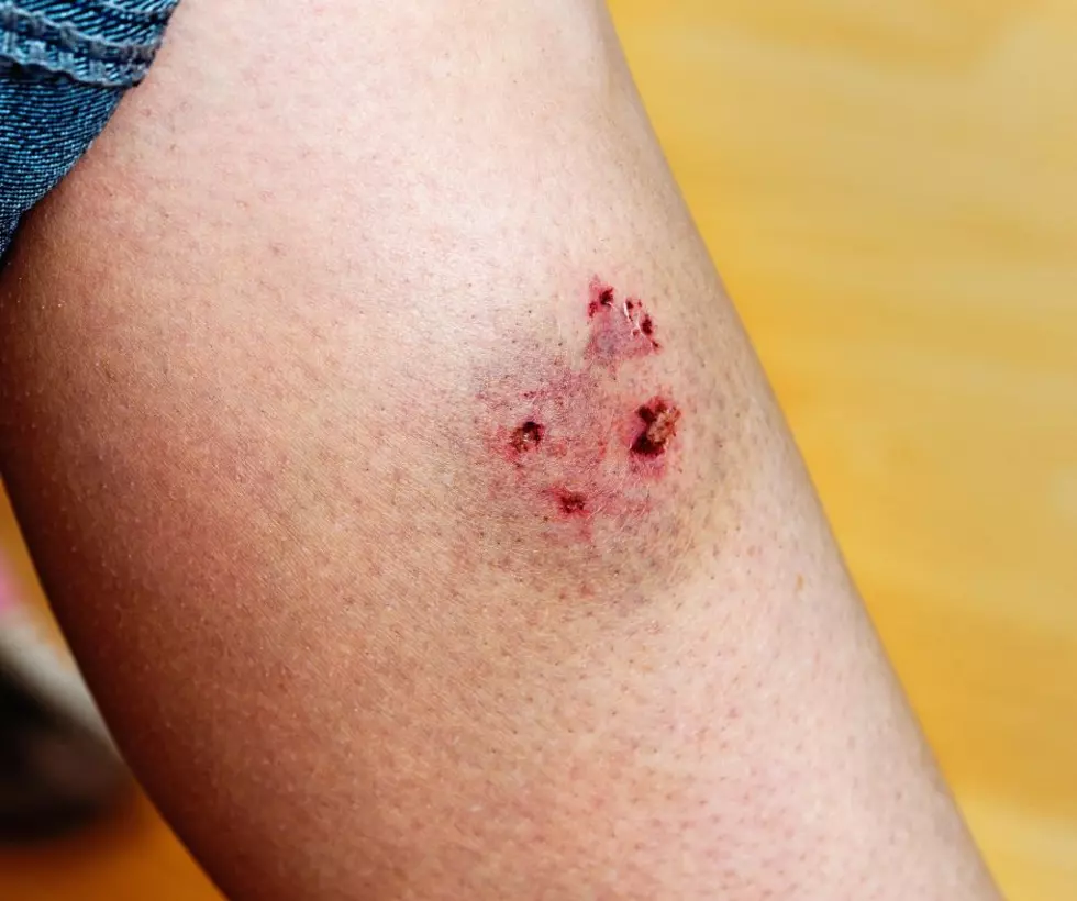 Karma: Dog Bites Illinois Shoplifter After She Bites A Cop