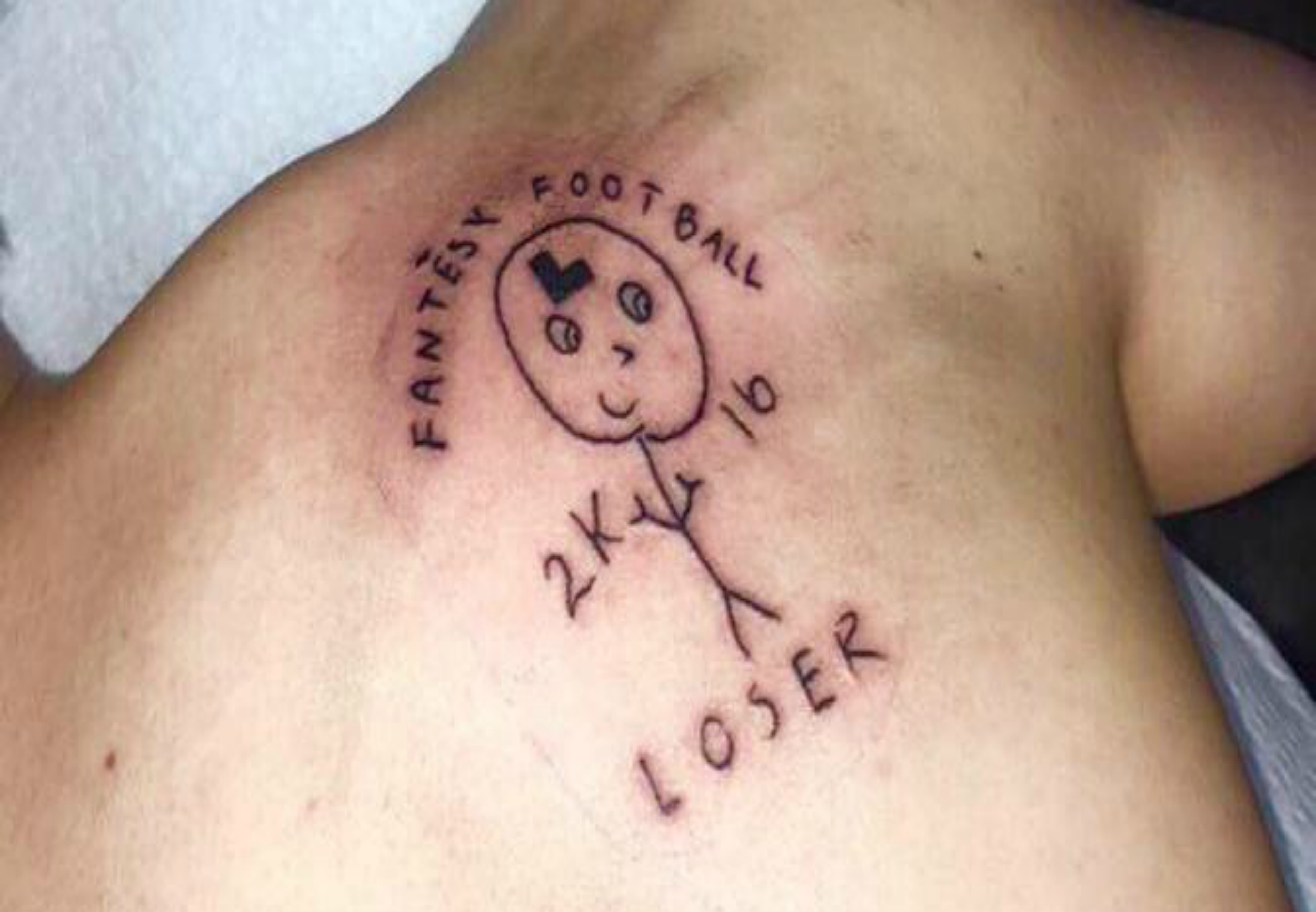 Matthew Berry on Twitter In honor of NationalTattooDay I present to you  the worst tattoo given to a loser of a fantasy football league  FantasyLife httpstcoTcg9CWZ6pZ  Twitter