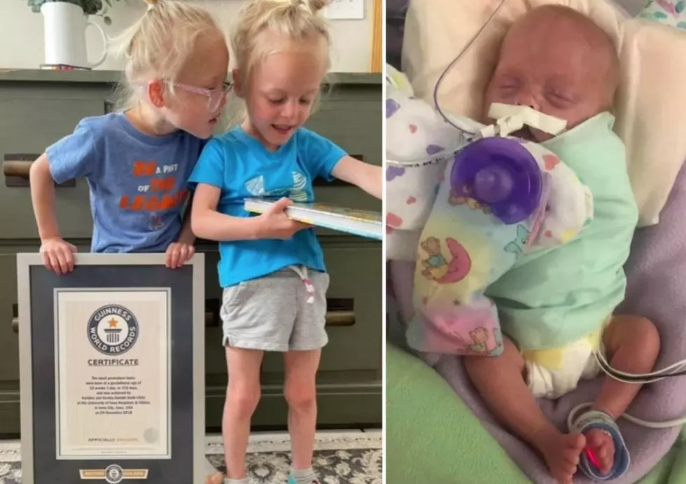 Iowa Twins Broke A World Record Before They Could Even Walk
