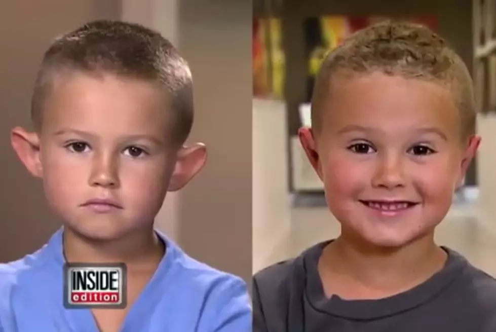 Parents Allow 6 Year Old To Get Plastic Surgery [VIDEO]