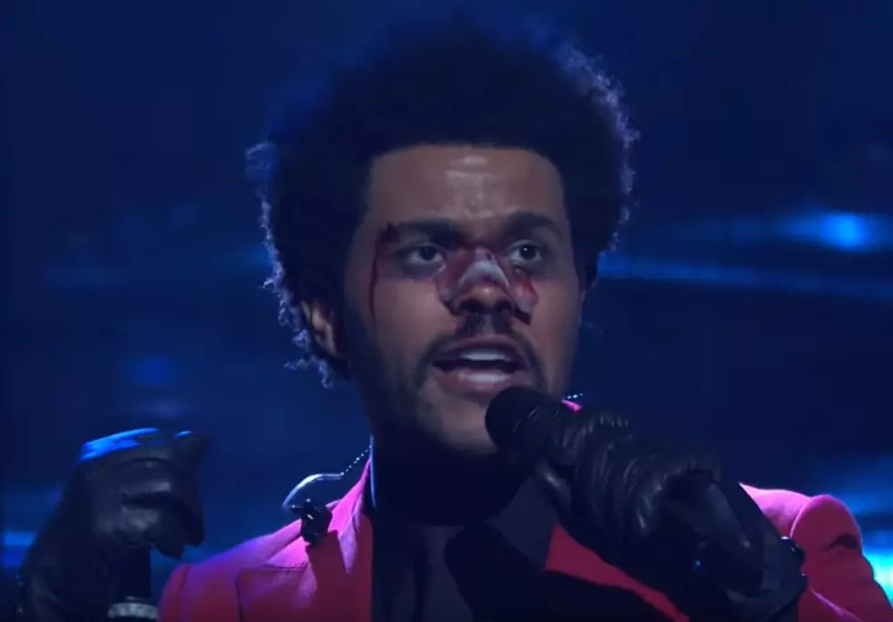 What Happened to The Weeknd’s Face on SNL?