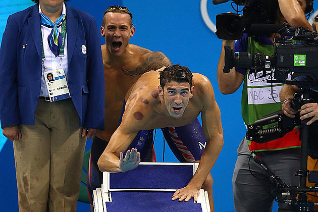 What the Heck Were Those Circles on Michael Phelps?