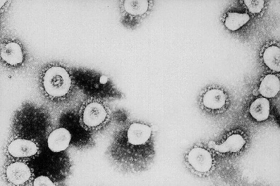 Governor Confirms First Kentucky Coronavirus Case Is in Lexington
