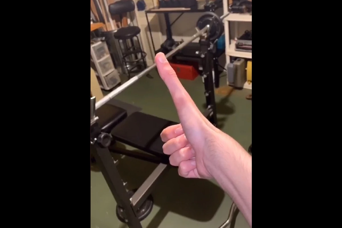Tik Tok Sensation Can Extend His Thumb Five Inches VIDEO