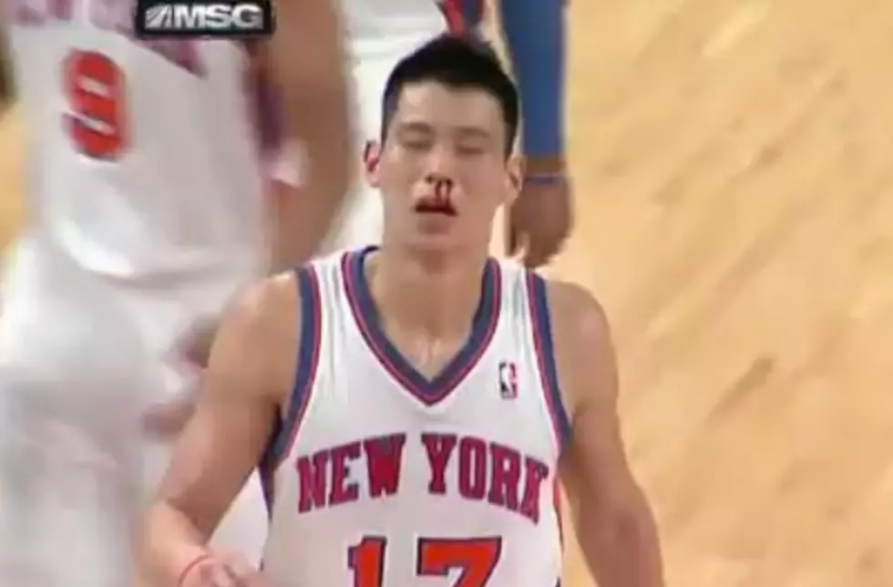 Jeremy Lin Gets A Bloody Nose Against Cleveland Cavaliers [VIDEO]