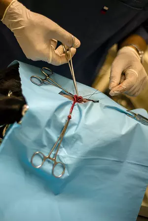 Cancer Patient Receives First Penis Transplant in the USA