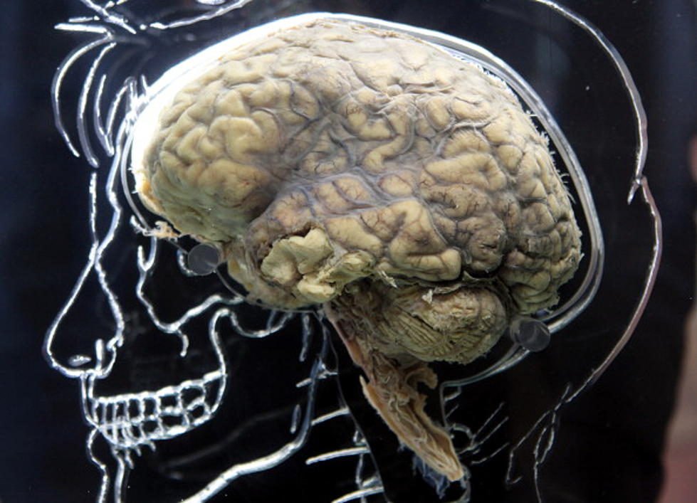 Alzheimer’s Disease Cases Could Double In Near Future