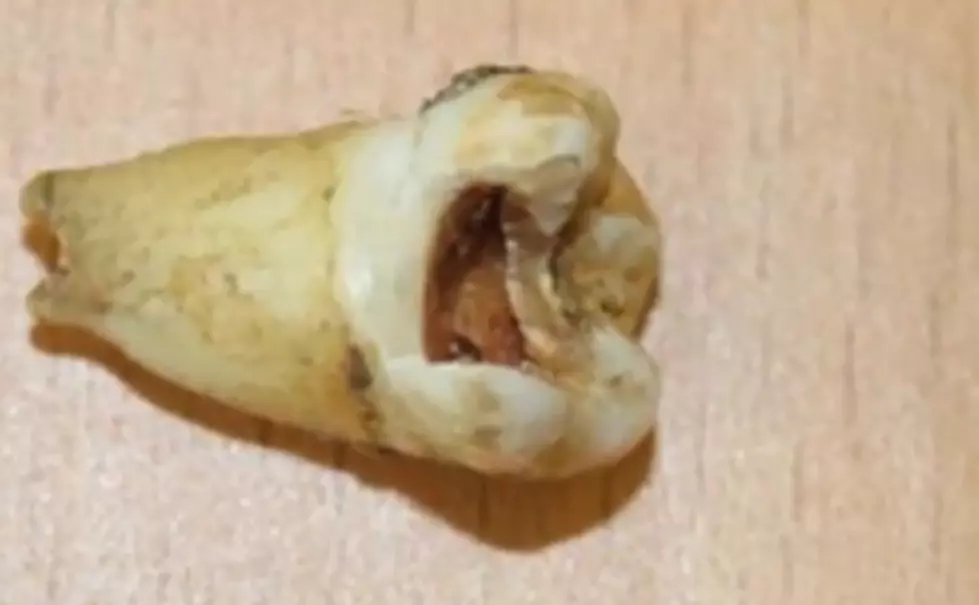 Canadian Dentist Wants To Use John Lennon&#8217;s Preserved Molar To Clone Him