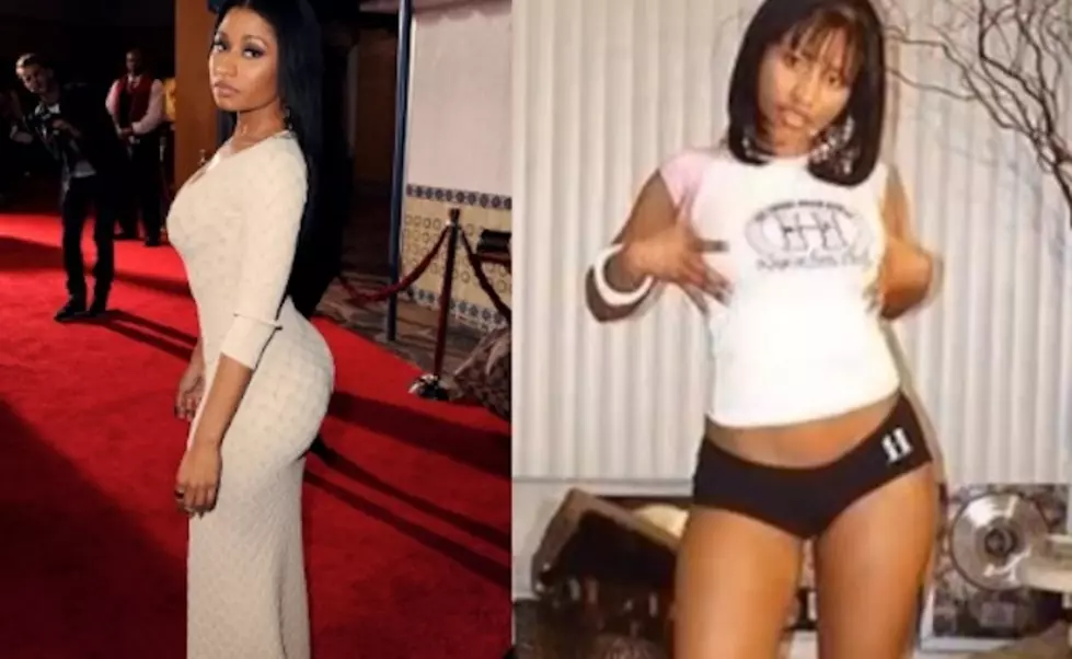 8 Hot Hip-Hop Celebs Before And After Plastic Surgery