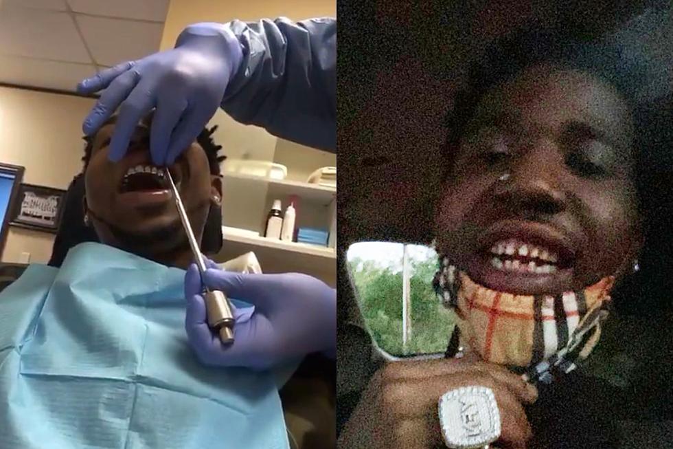 YFN Lucci Removes Permanent Grills and Shocks the Internet With His Real Teeth