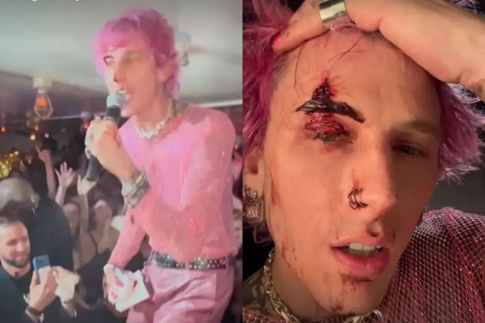 Machine Gun Kelly Cracks Drinking Glass on His Face During Show