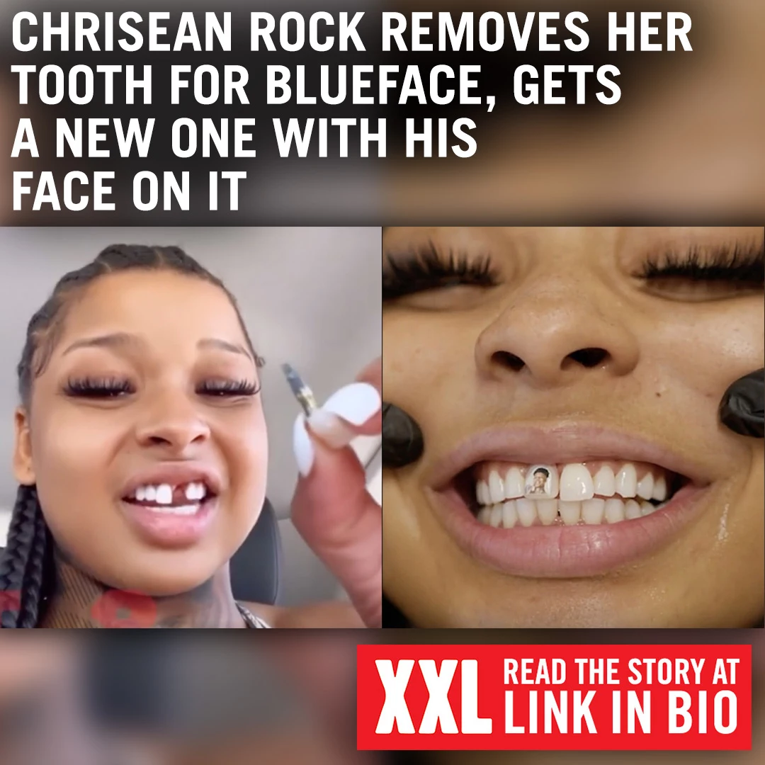 Chrisean Rock Gets a New Tooth With Blueface's Face On It - XXL