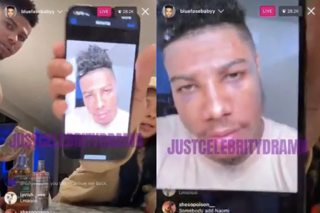 Chrisean Rock Shows Photo Of Blueface With Two Black Eyes 977 The