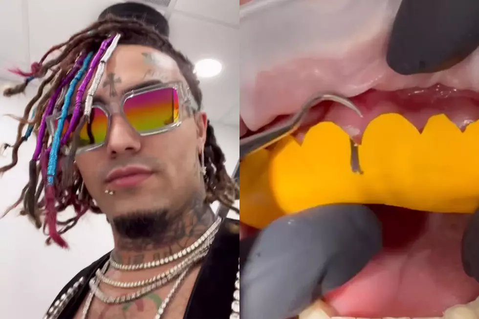 Lil Pump Spends $25,000 on New Teeth - Watch