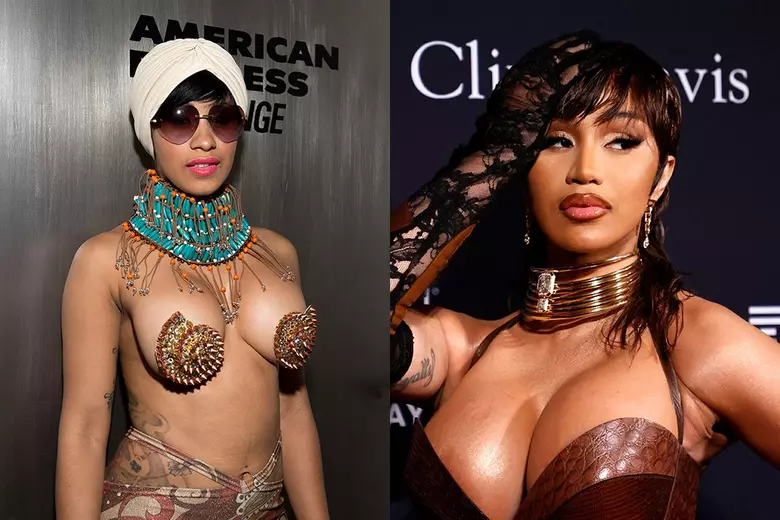 Female Rappers Who Have Publicly Embraced Getting Plastic Surgery - XXL
