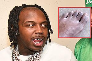 EST Gee Blames Arizona Water for His Foot Looking Ashy in Video...