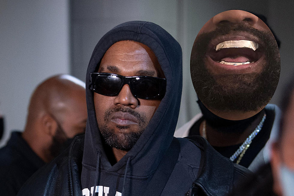 Kanye West Did Not Remove His Teeth