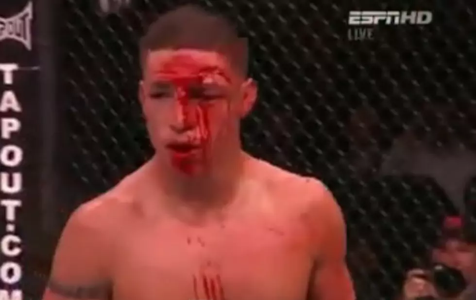 The Worst and Most Brutal Injuries in The MMA Ever [VIDEO]