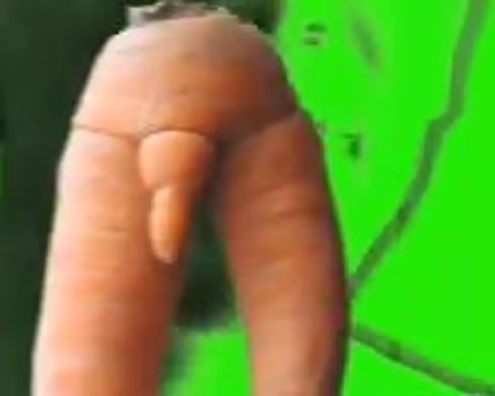 Are You Really What You Eat? Watch Vegetables That Look Like Penises [VIDEO]