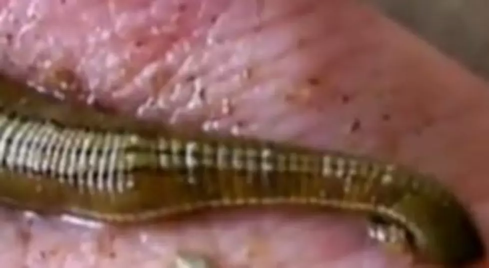 Woman FInds 3-Inch Leech In Her Nose [VIDEO]