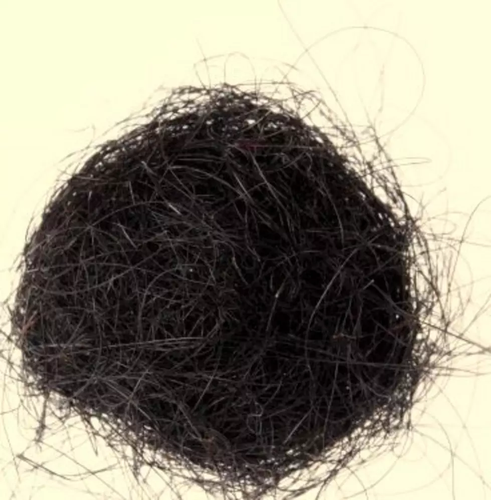 9-Pound Hairball Removed From Girls Stomach [VIDEO]