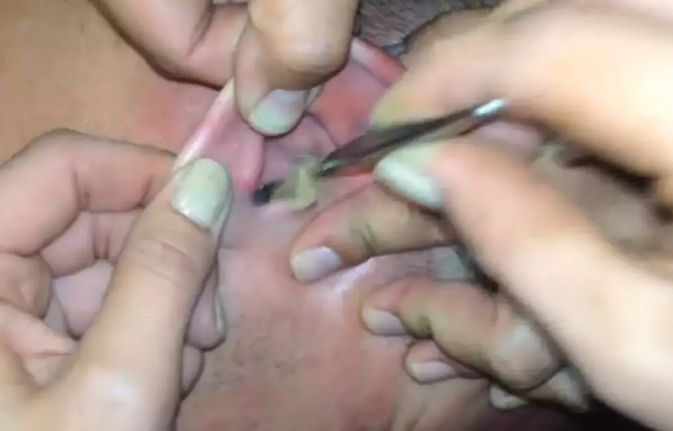 Guy Gets Moth Stuck in Ear&#8230; But, Unfortunately, That&#8217;s Not All [VIDEO]
