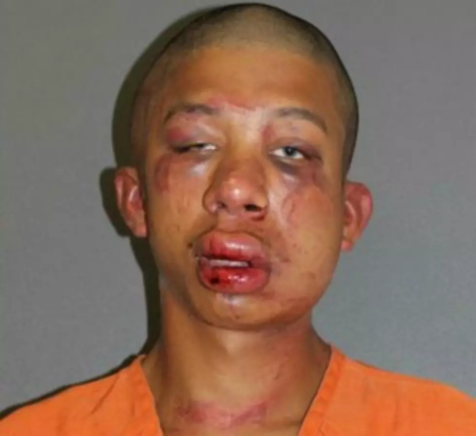 Father Viciously Beat Teen Molester Until Police Arrived