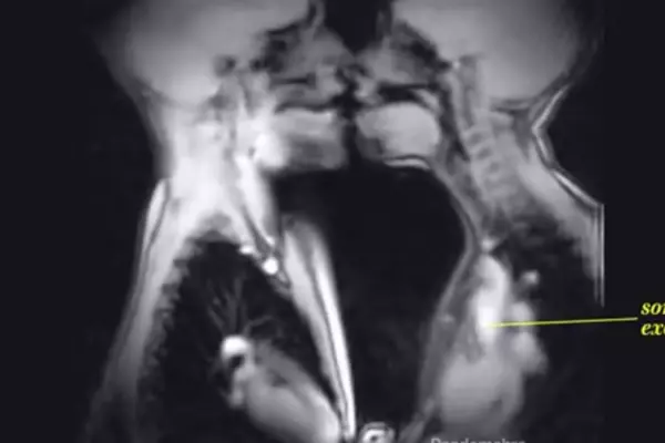 This Is What Sex Looks Like Inside An Mri Scanner Video 7756