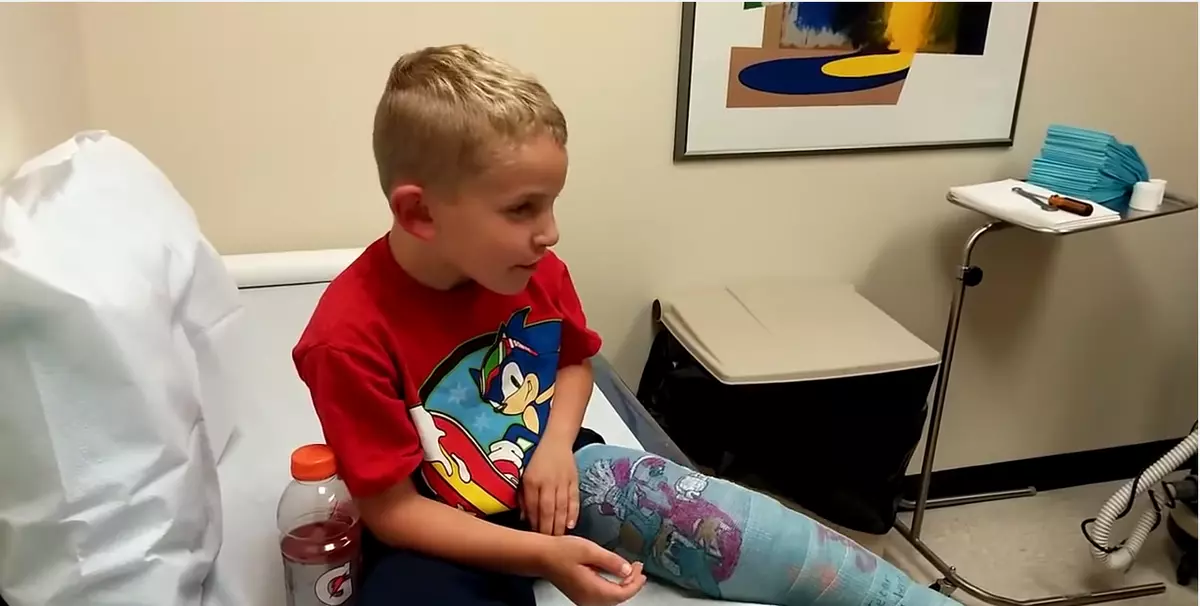 Kid Reaction to Getting His Cast Off is Awesome NSFW - Video.