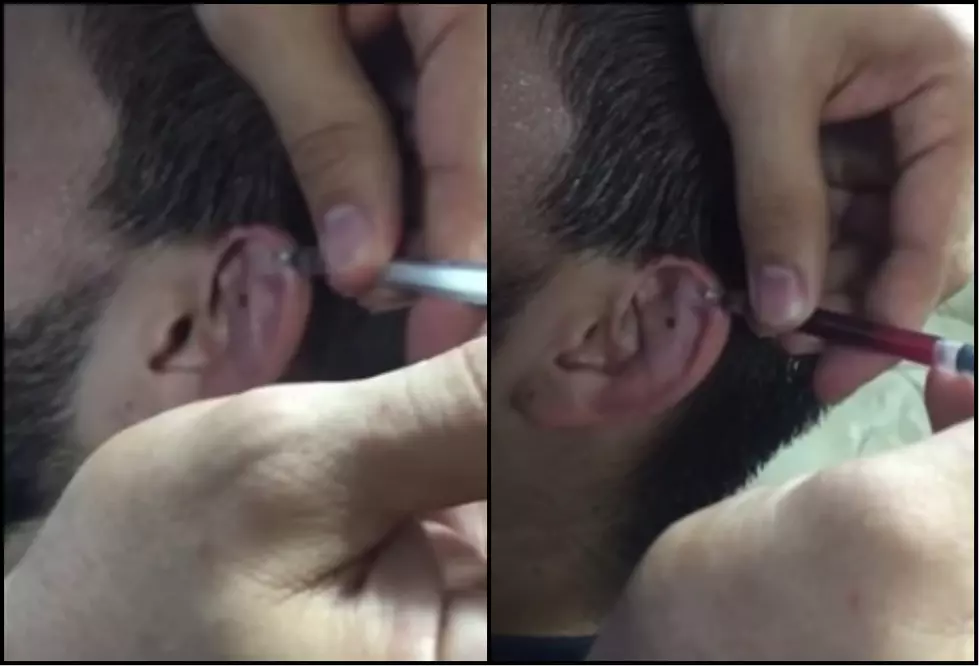 Jiu Jitsu Practice Turns Into Blood Bubble Being Drained From Ear [Video]