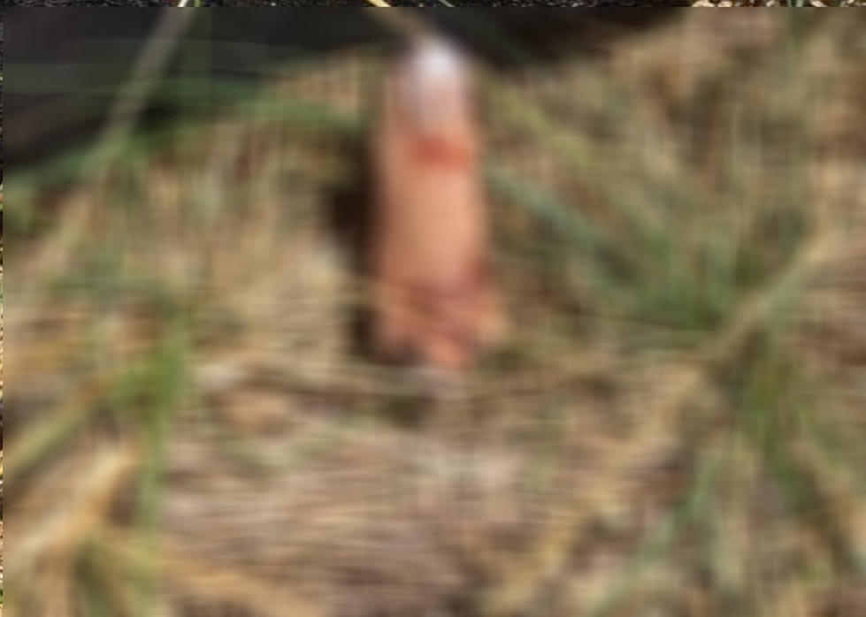 Wait, Did Someone Really Lose A Finger At Electric Forest?